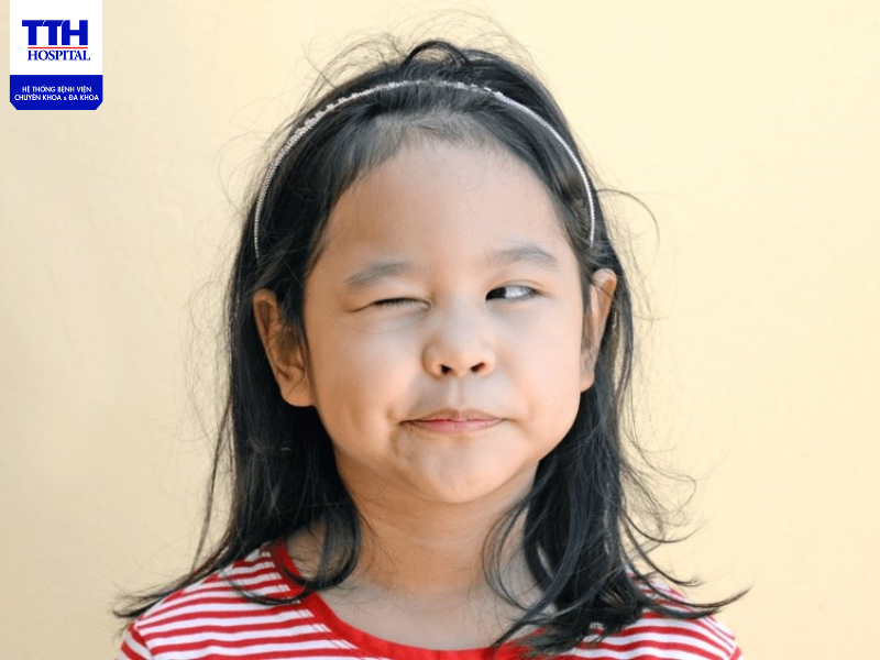 NGUYÊN NHÂN VÀ CÁCH ĐIỀU TRỊ HỘI CHỨNG RỐI LOẠN TIC Ở TRẺ EM